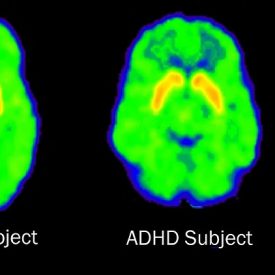 CBT changes your brain 3 | Meredith Cary, PsyD