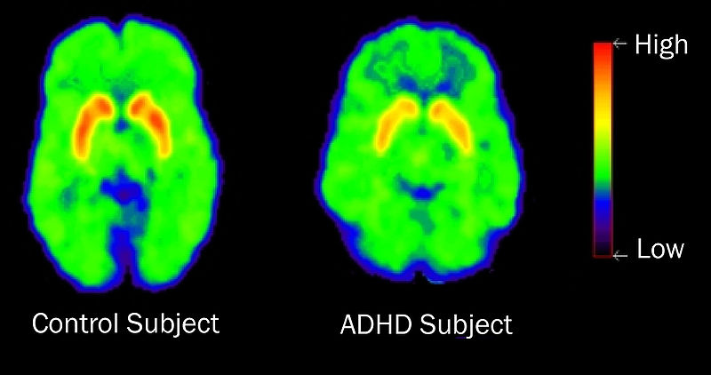 How we change our brain - in minutes 6