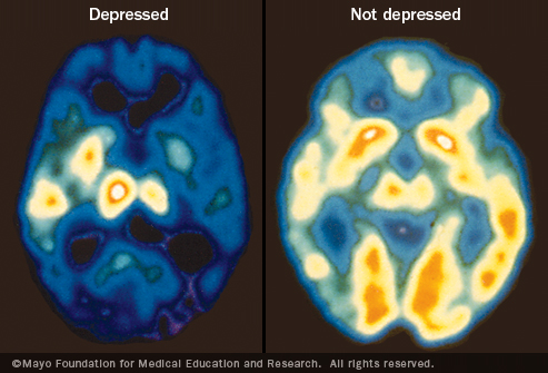 How we change our brain - in minutes 5