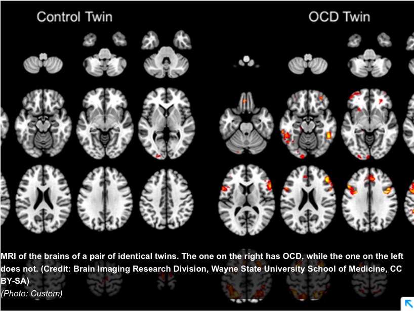 How we change our brain - in minutes 4