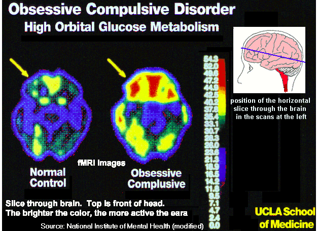 How we change our brain - in minutes 2