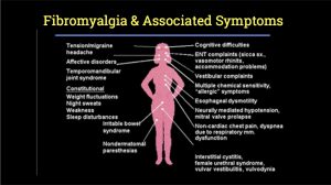 Fibromyalgia