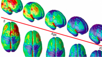 Your Brain – A Work in Progress thumbnail